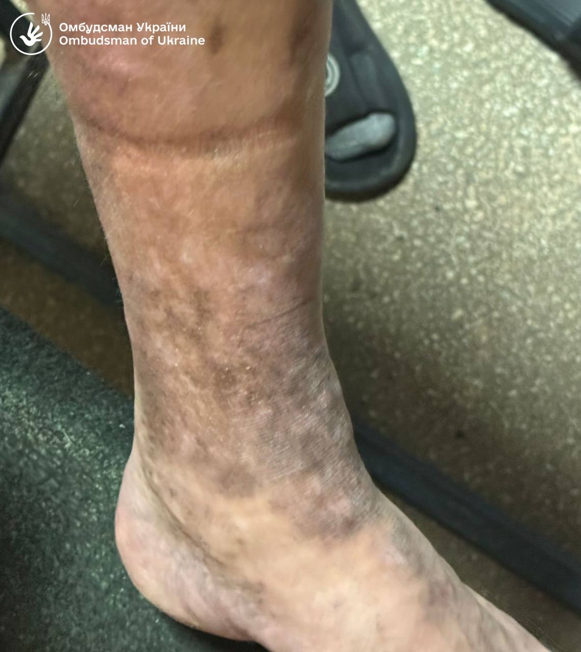 В Ужгородському ТЦК людей незаконно утримували тижнями – омбудсман